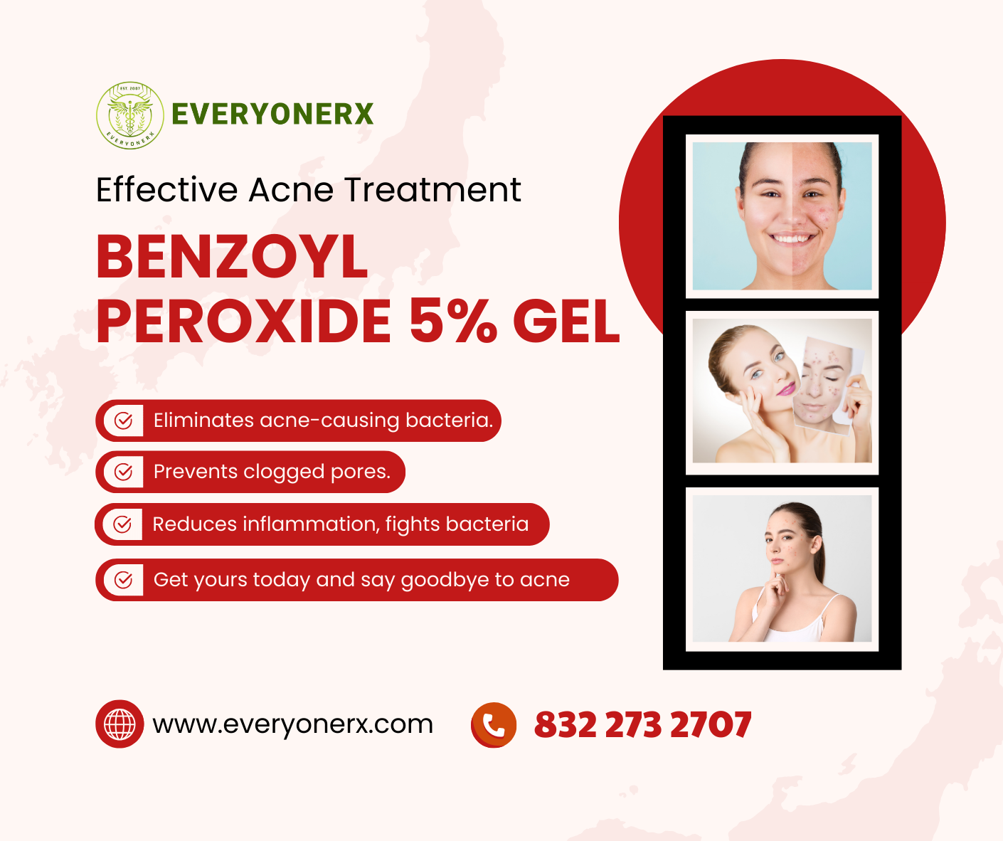 Benzoyl Peroxide 5% Gel: An Effective Solution for Acne Treatment